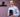 Best Ankle Brace for Orthotists